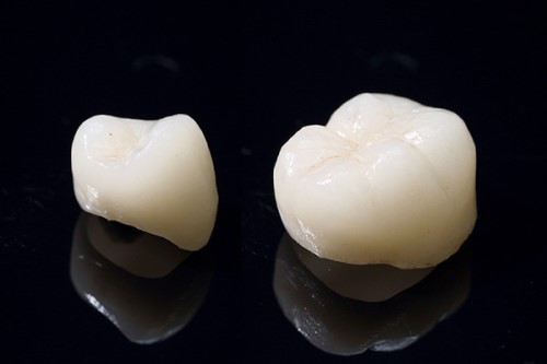 ジルコニアボンド